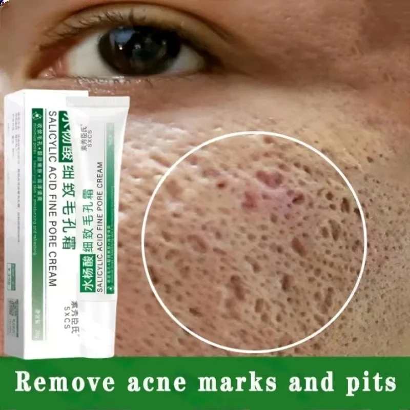 Krim Pembersih Pori Asam Salis - Salicylic Acid Blackhead Remover ulasan dan harga