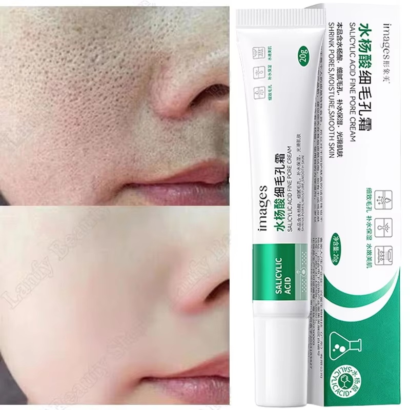 Krim Pembersih Pori Asam Salis - Salicylic Acid Blackhead Remover ulasan dan harga